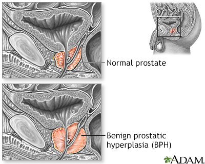 Cum During Prostate Exam 7970