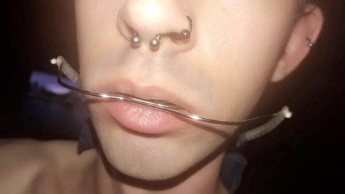 brenda mundt add Twinks With Braces photo