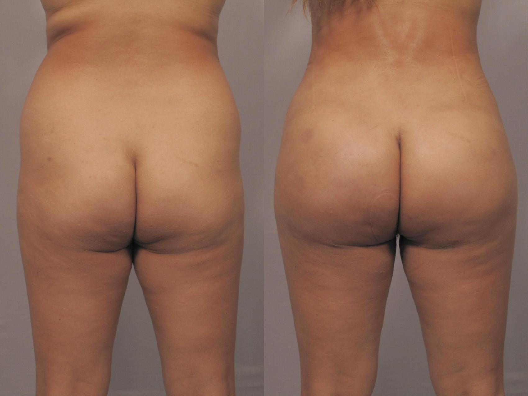 david paolino add Fat Naked Butt photo