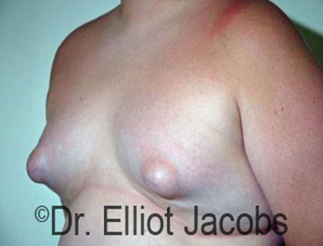 diana aldarondo add Little Puffy Tits photo