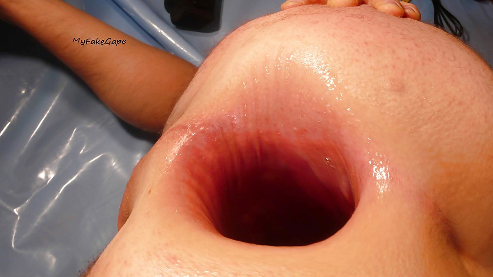 bing medina add Biggest Anal Gape photo