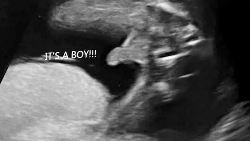 beqa esiava add Porn Ultrasound photo