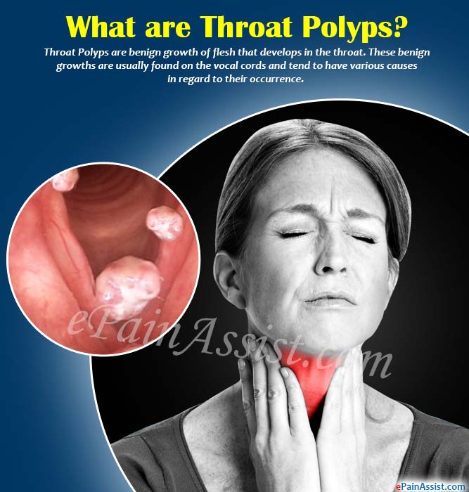 christine duffey add Deep Throat Puke photo