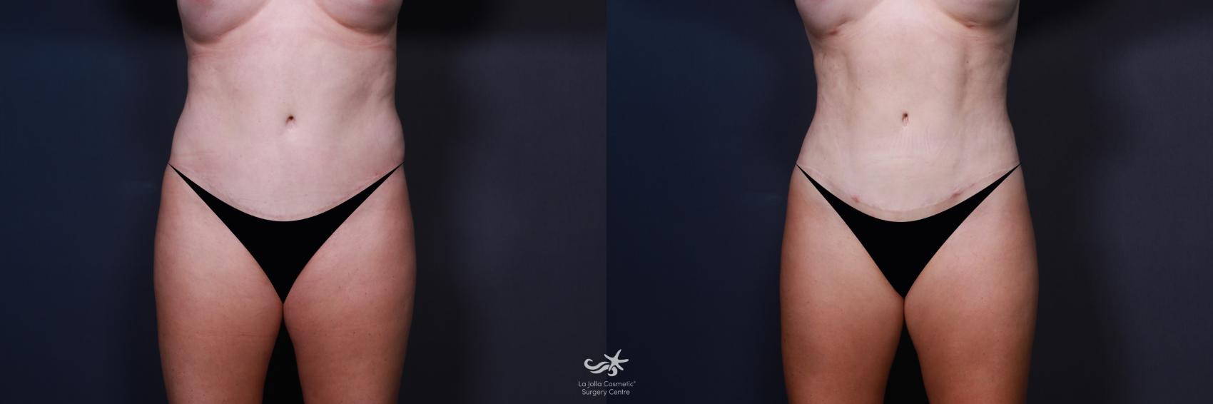 bui phan add High Definition Erotica photo