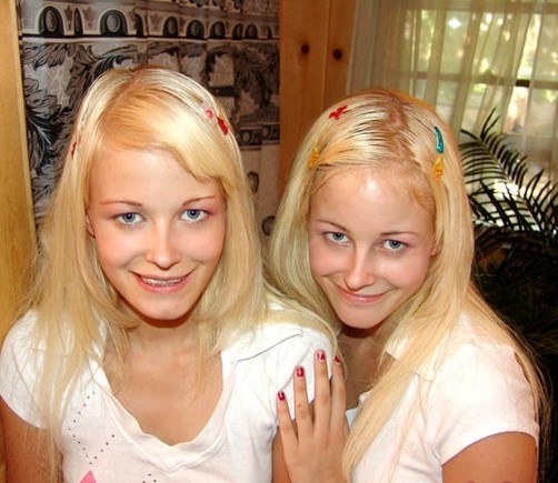 brent searle add Milton Twins Lesbian photo