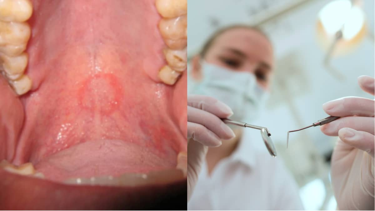 bobby archambault add Rough Oral photo