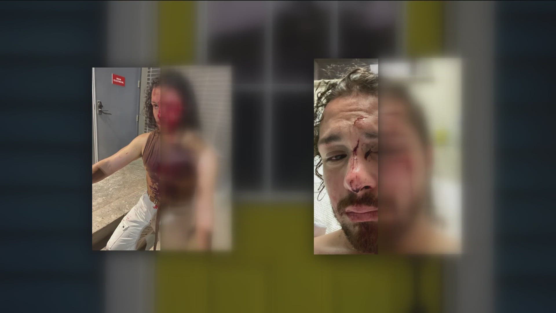cameron loose add Face Bashed photo