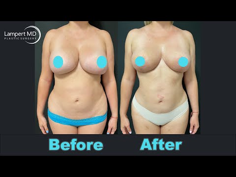 benson tse add Huge Tits Fat photo