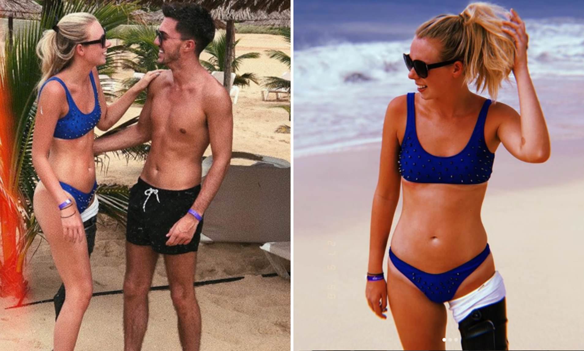 atari smith add Amputee In Bikini photo