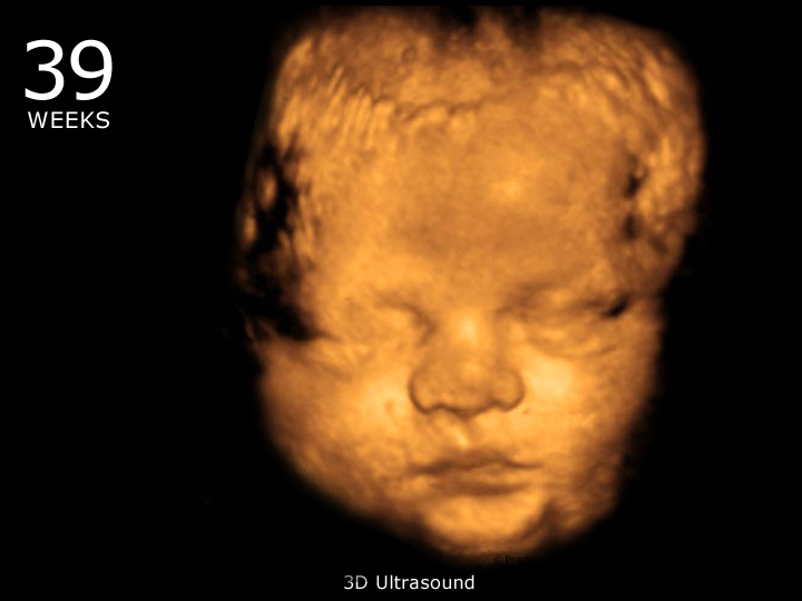colin brew add 3d Pregnancy Porn photo