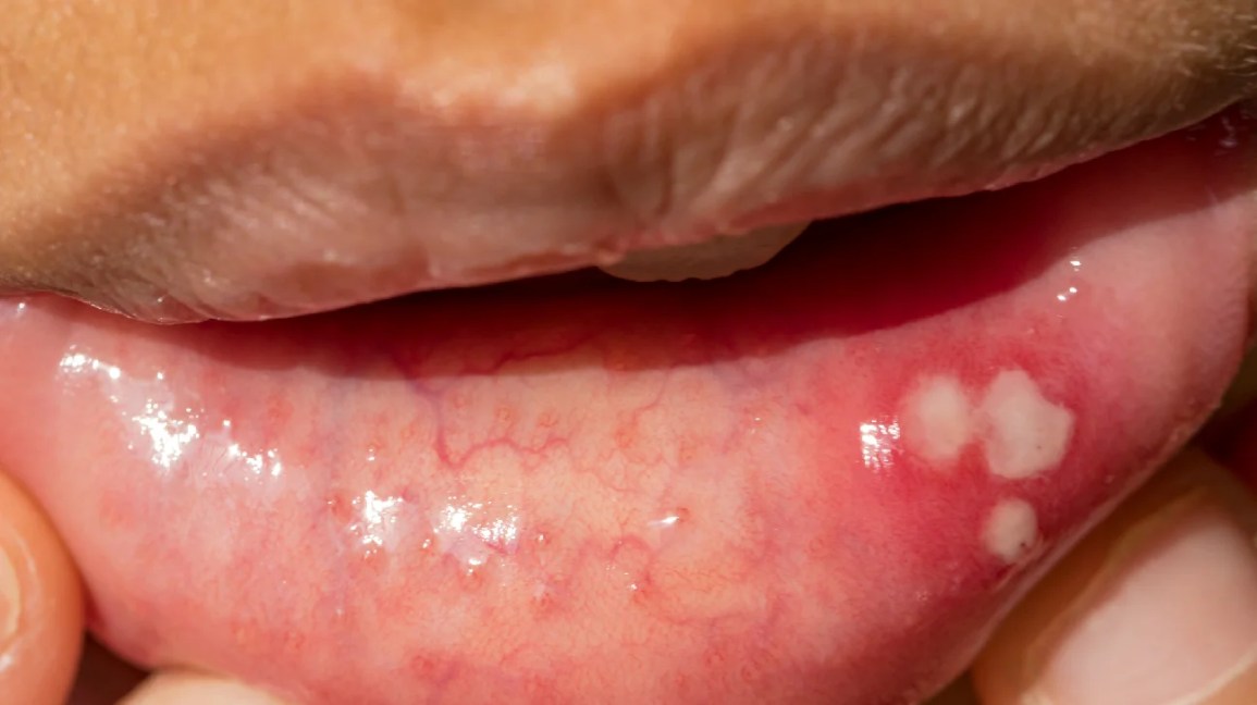 allysa smock add Cumshot To Mouth photo