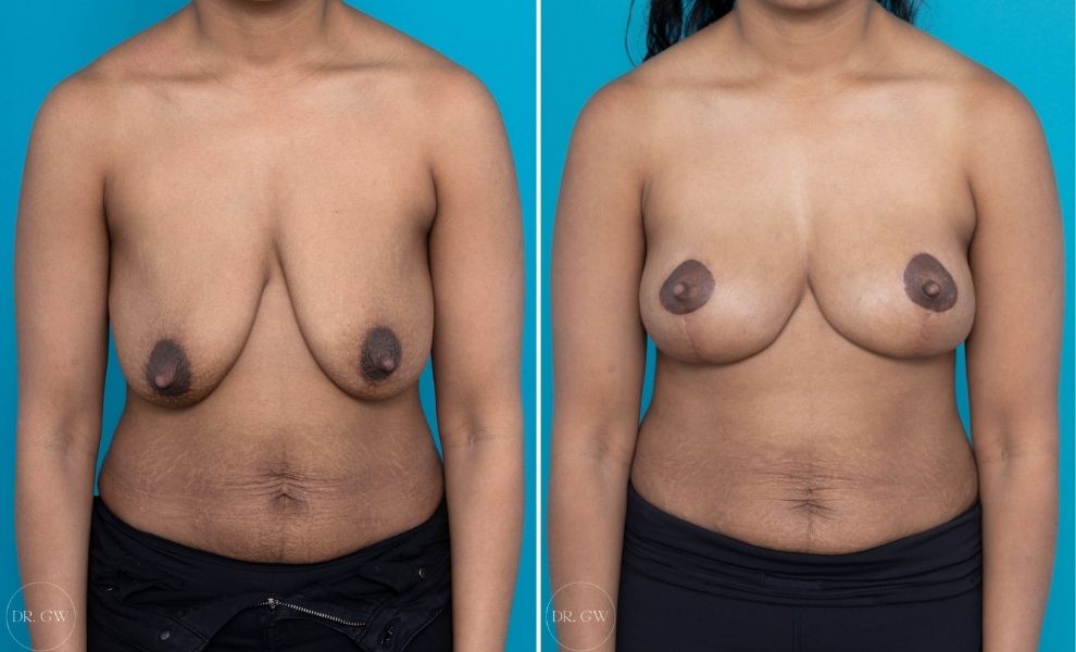 abdul rasheed p add Biggest Saggy Tits photo