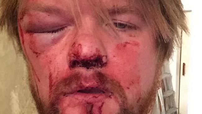 diane cramer add Face Bashed photo