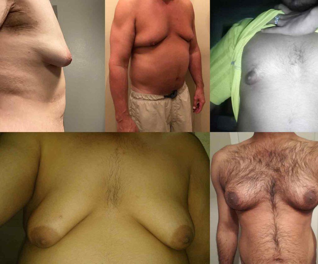 alaa samhat add Long Nipplles photo