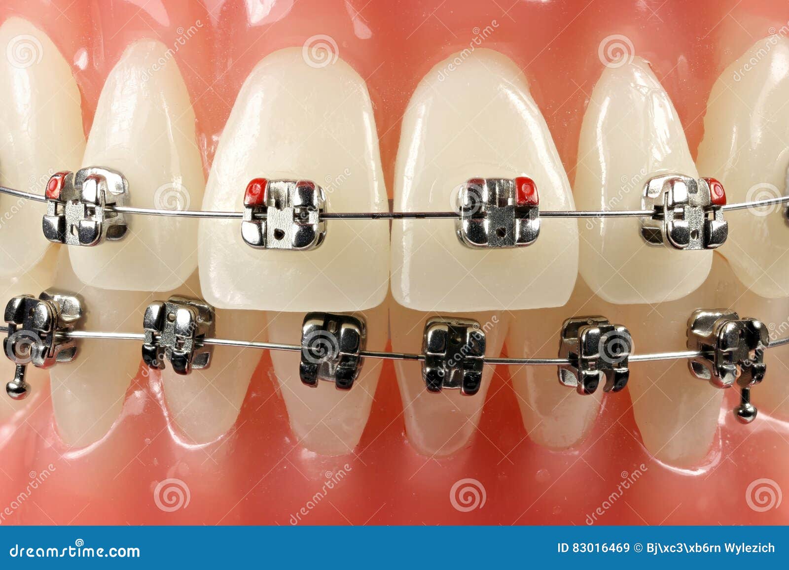 courtney truax add Bj Braces photo