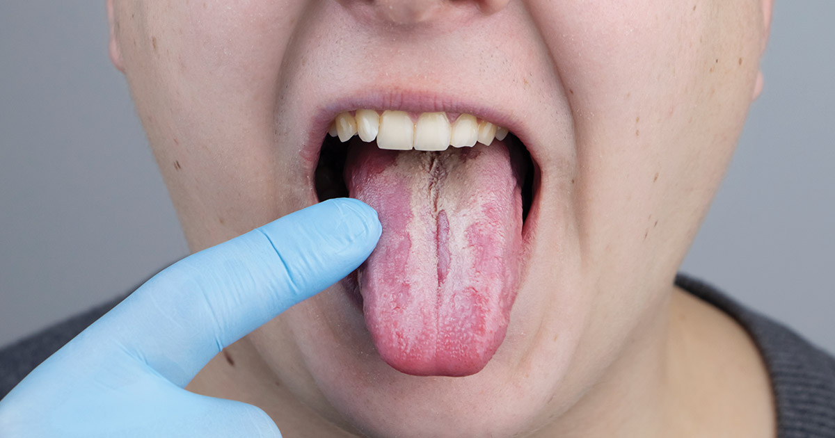celestino add Rough Oral photo