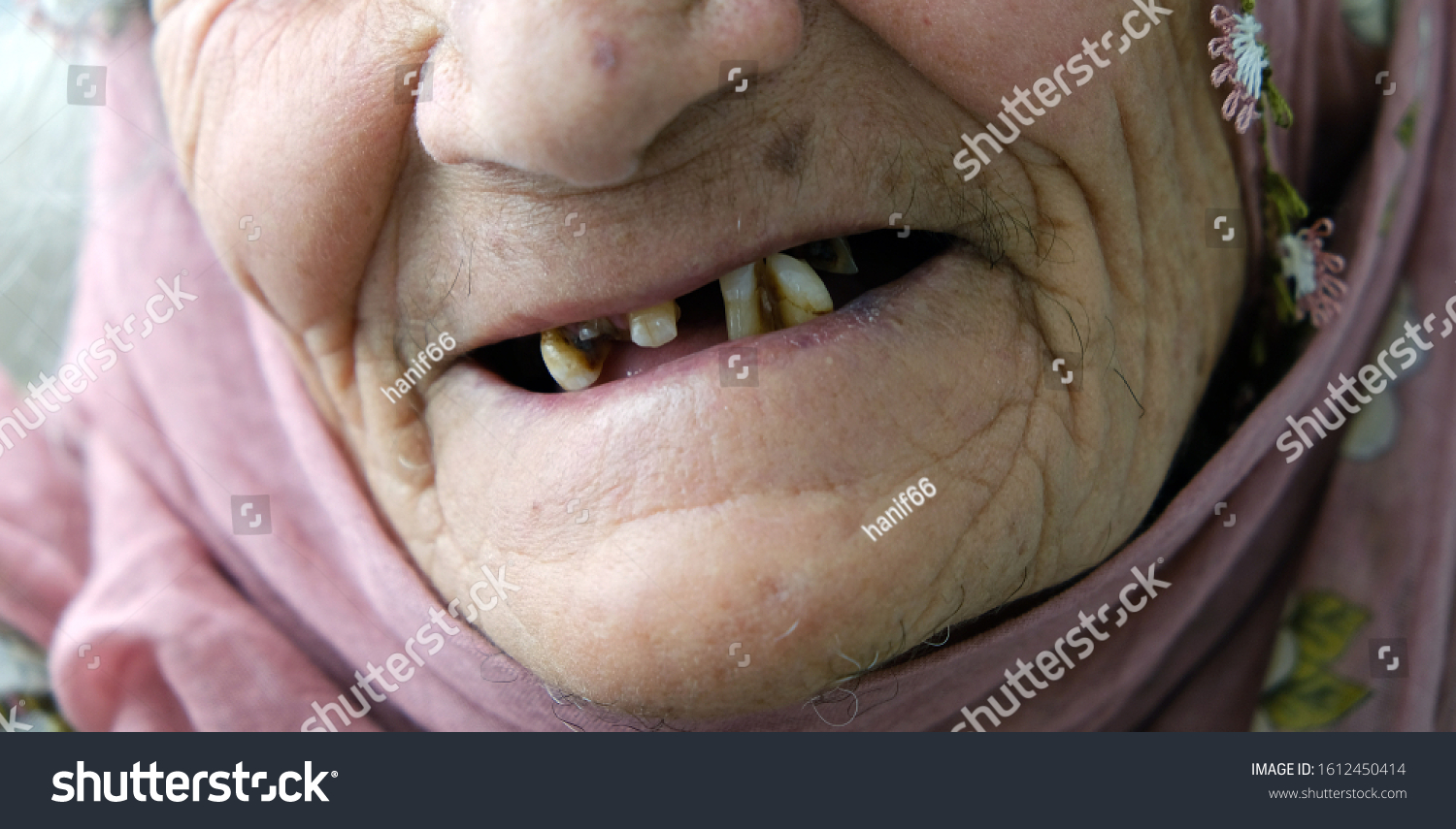 dawn bowater add No Teeth Old Lady photo