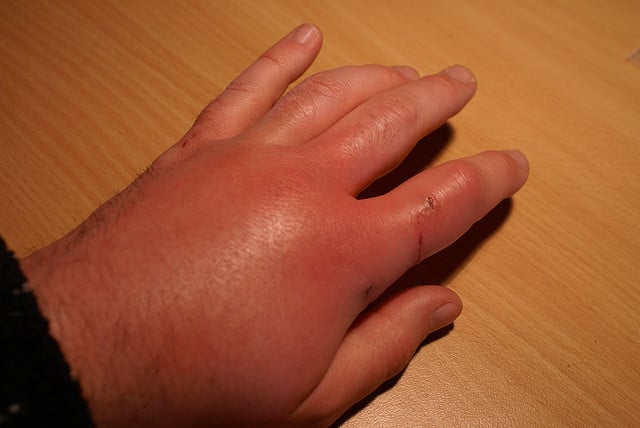 andrew nyce add Hand Cumshots photo