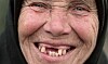 allan cryer add No Teeth Old Lady photo