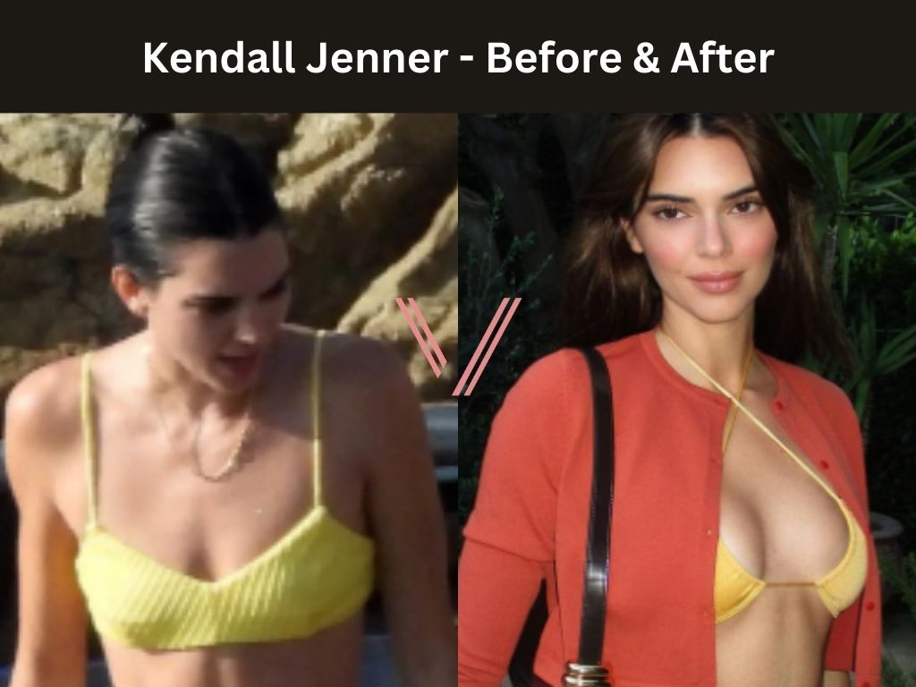 benedict liew add Nina Dobrev Boobs photo