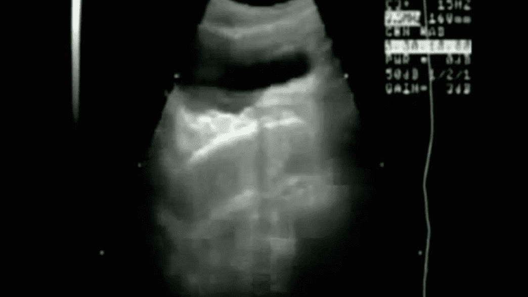 ajitesh reddy add Porn Ultrasound photo