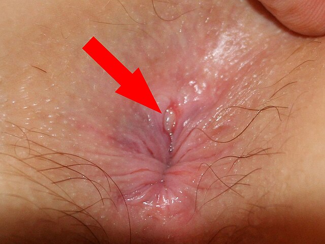darnell tyms add Asslicking Cumshots photo