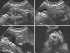 deb dale add Porn Ultrasound photo