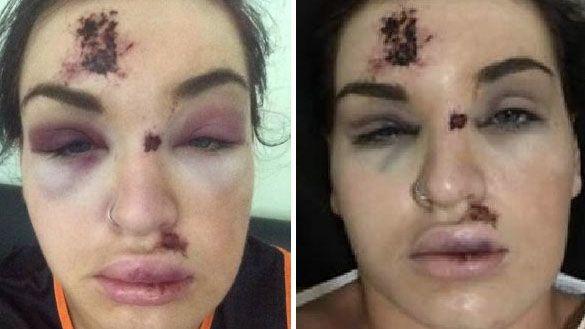 craig gehr add Face Bashed photo