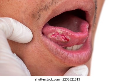 ac de vera add Rough Oral photo