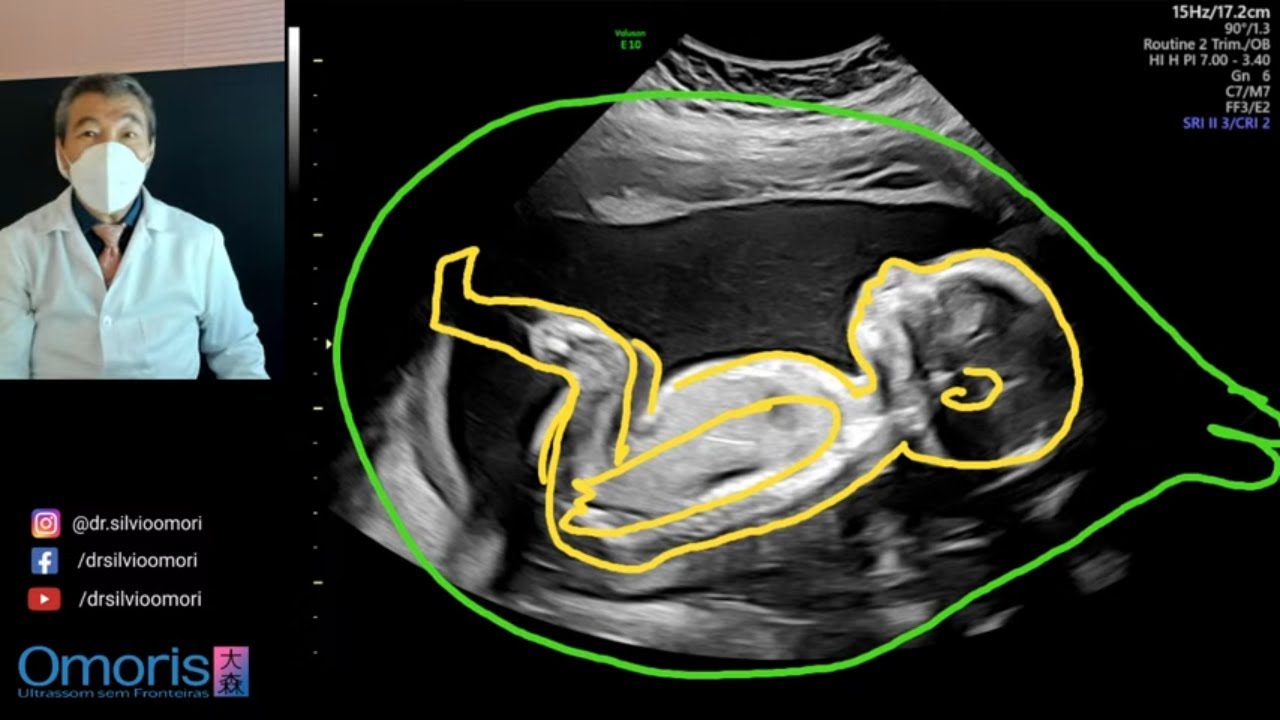 dan goodine add Porn Ultrasound photo