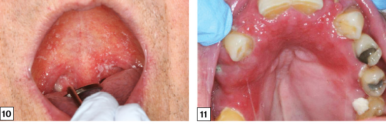 ashley naugher add Rough Oral photo