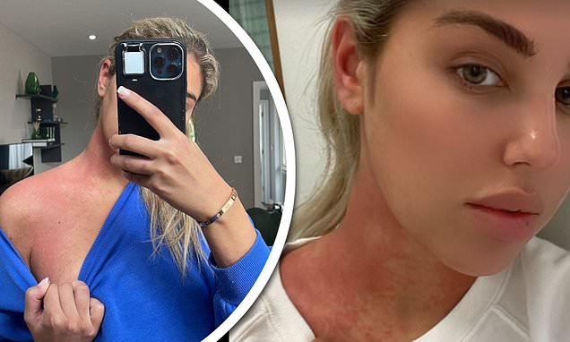 Mia Malkova After Surgery 2418