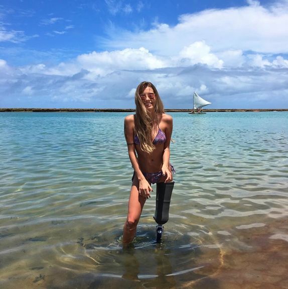 brooklyn matthews add Amputee In Bikini photo