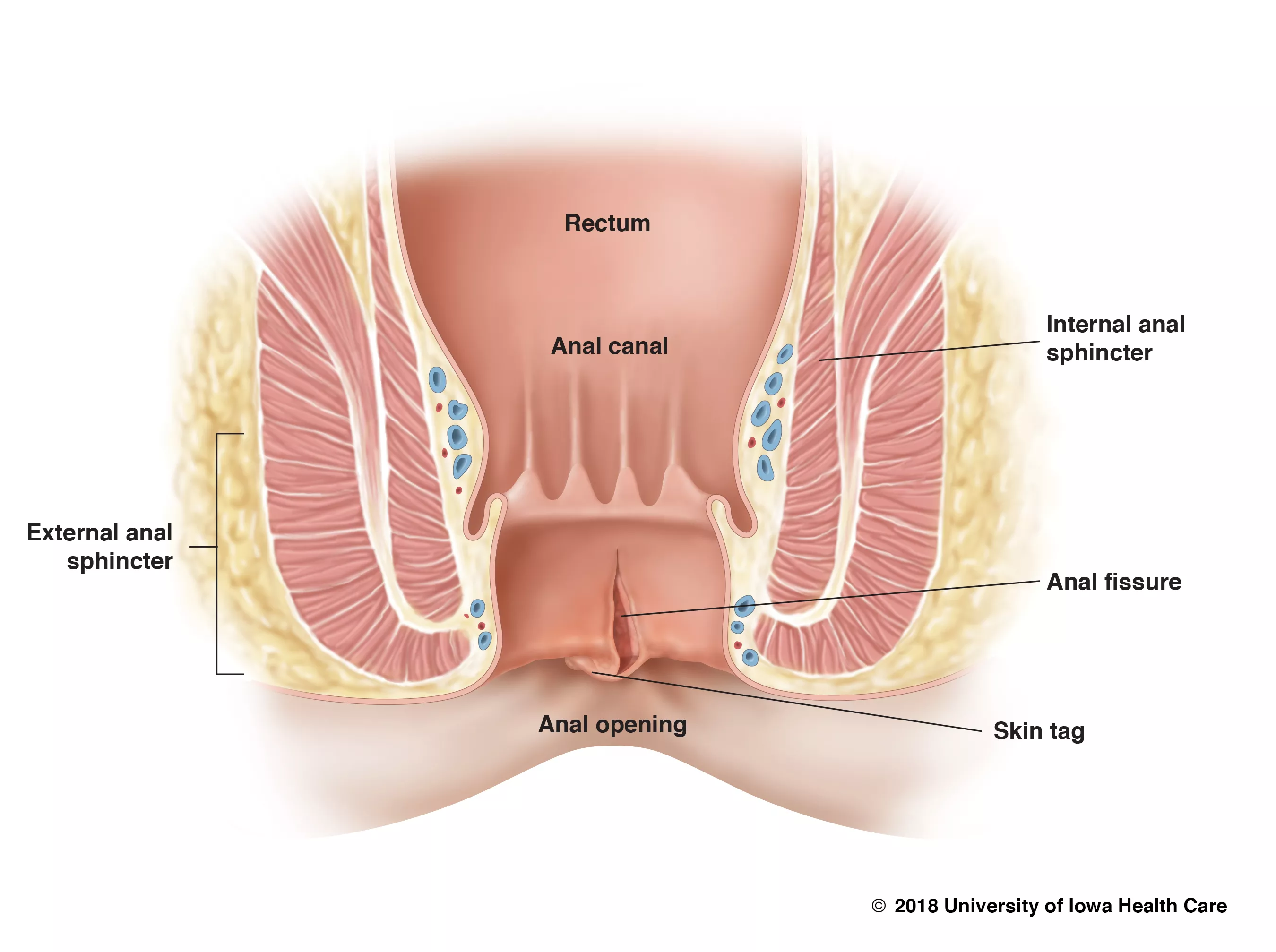 chad dunson add Anal Pain Face photo