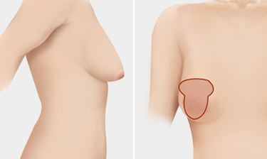 donna negus add Upturned Tits photo