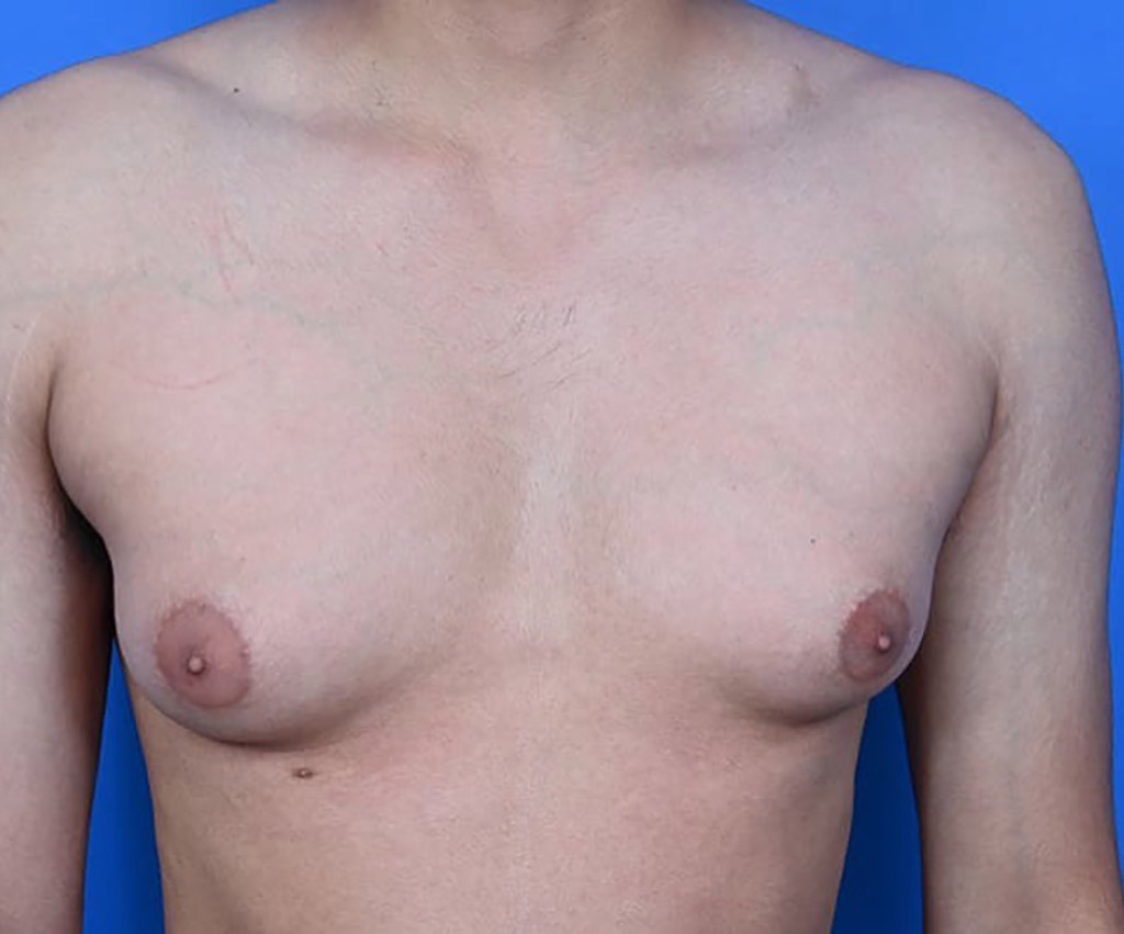 amy bennis add Big Niples Boobs photo