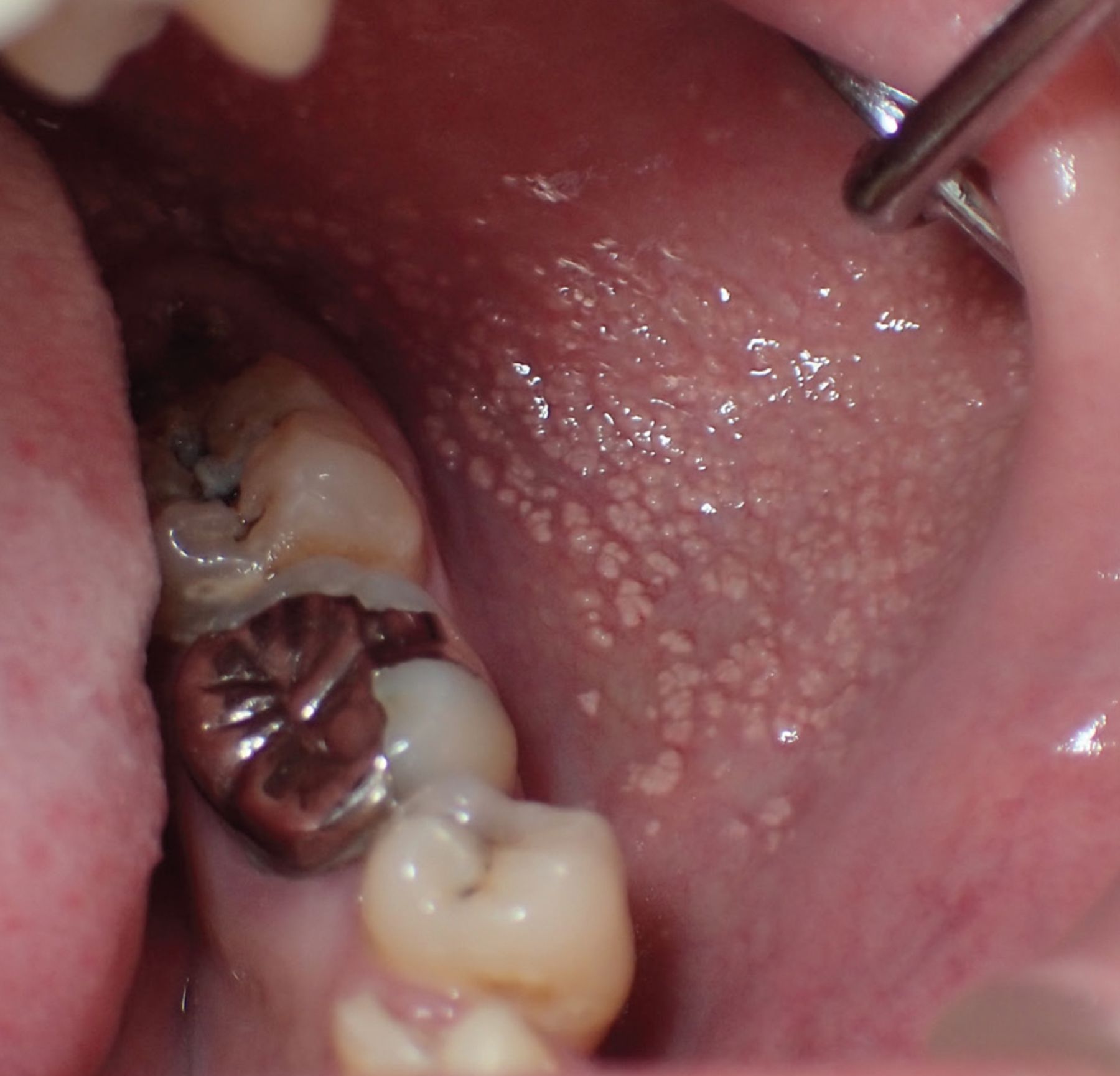 bryan paradis add Rough Oral photo