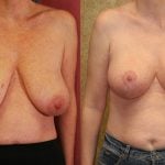 david l parks add Big Floppy Knockers photo