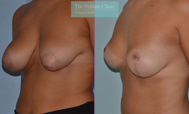 amina jackson add Long Nipplles photo