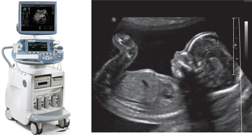 ashley scheafer add Porn Ultrasound photo