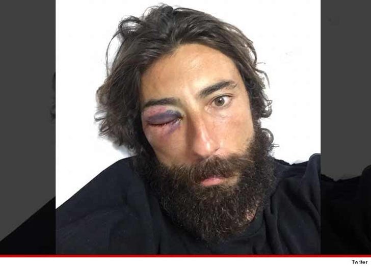 andrea nevil add Face Bashed photo