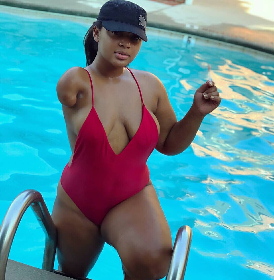 amie lawson add Amputee In Bikini photo