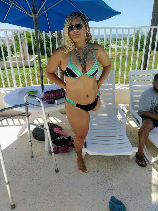 claire bonfield add Amputee In Bikini photo