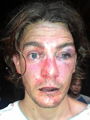 donna mcfadzean add Face Bashed photo