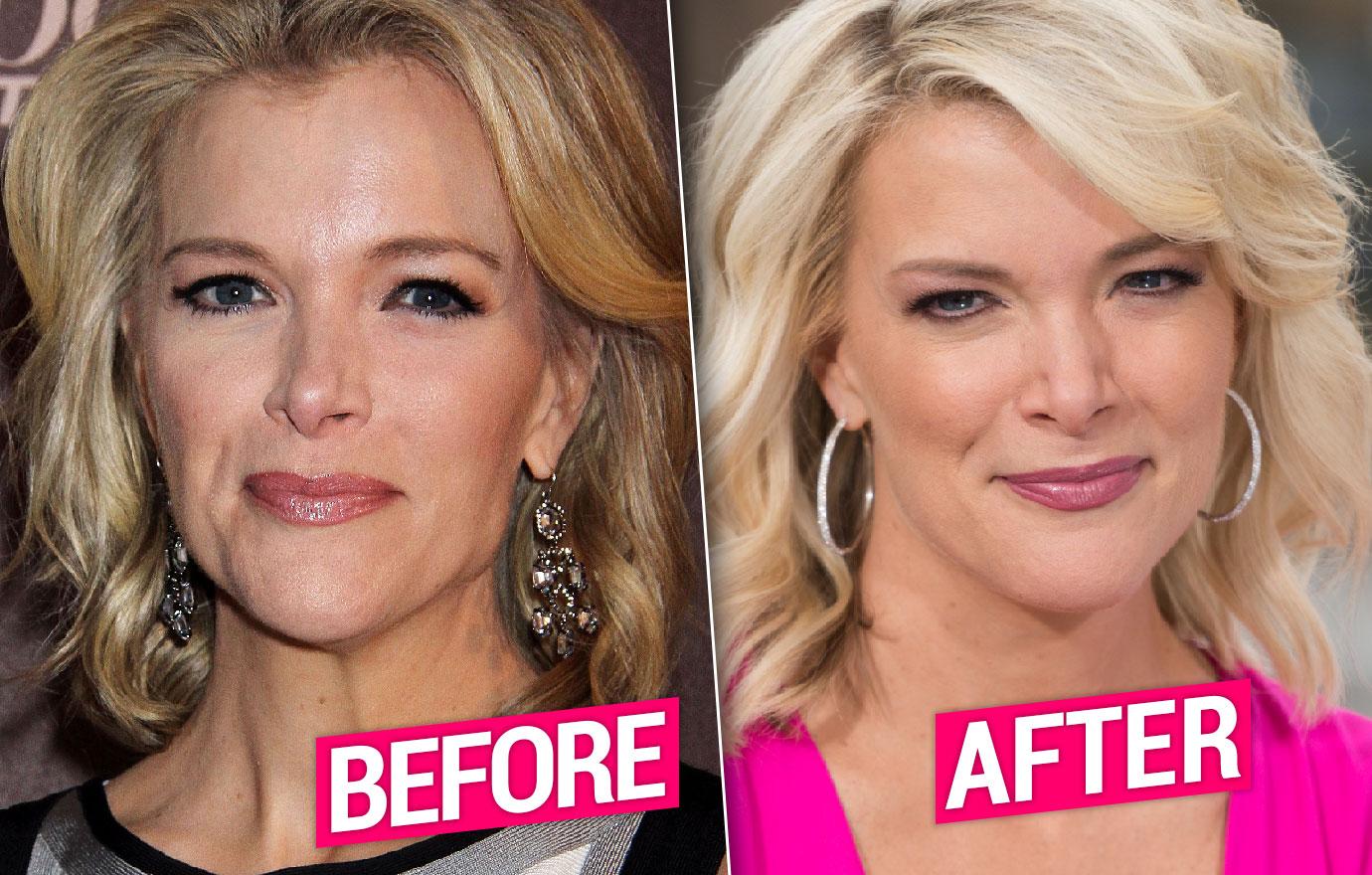 dave norcross add Megyn Kelly Boobs photo