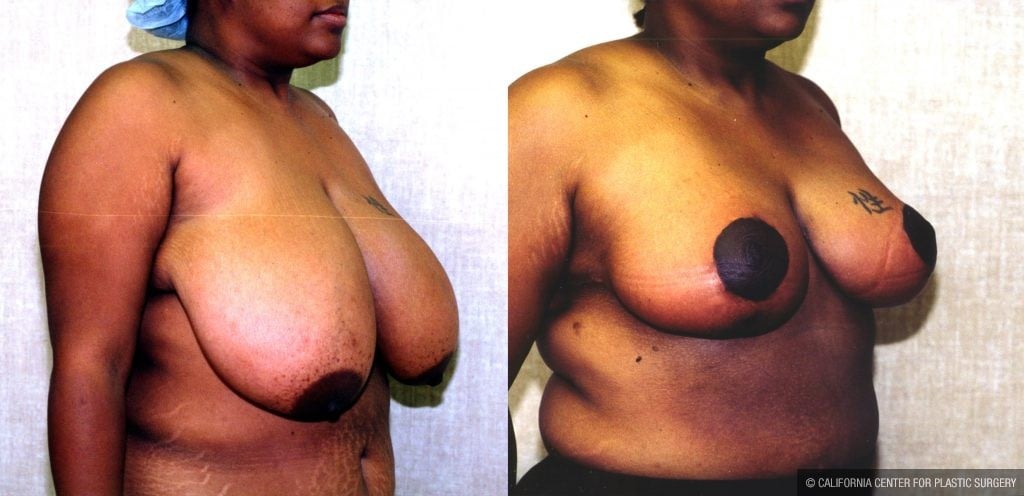 danny nicholas add Big Saggy Titty photo