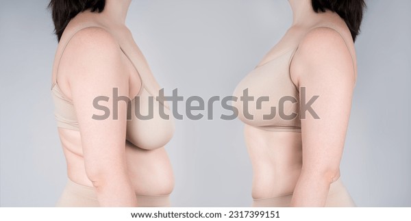 clare mcarthur add Biggest Saggy Tits photo