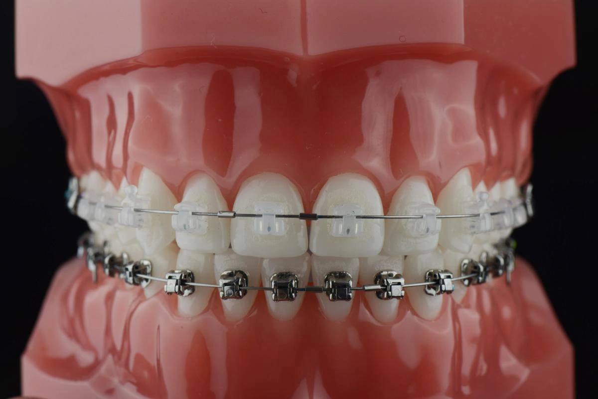 dan risner add Bj Braces photo