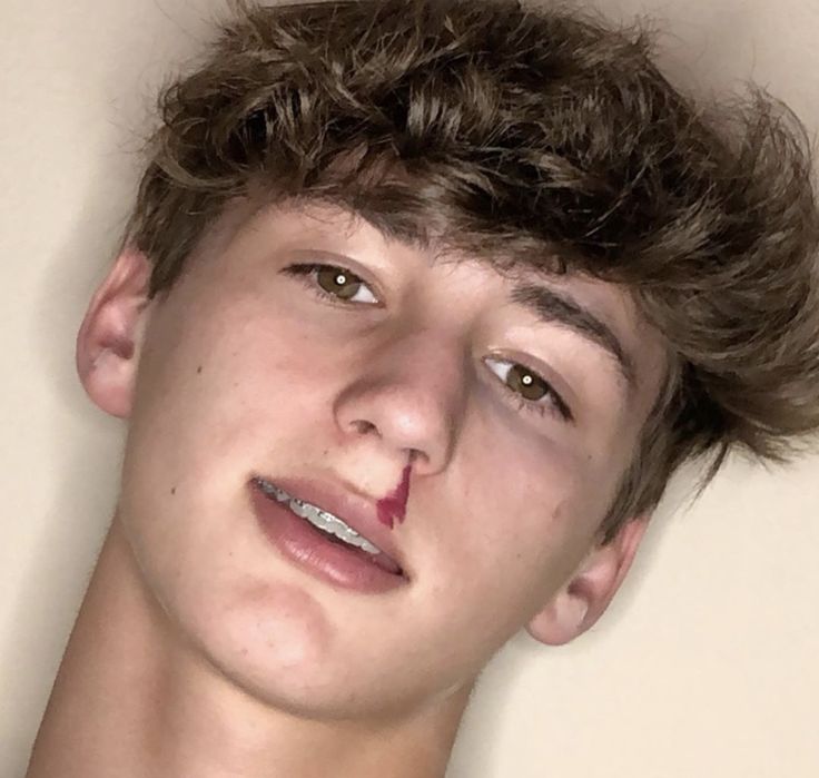 ahammed abdul add Twinks With Braces photo