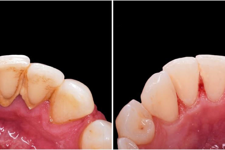 chinmoy kumar mondal add Rough Oral photo